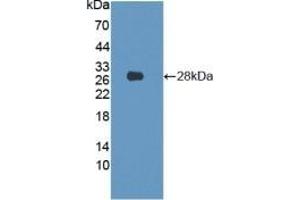 Detection of Recombinant LMNB1, Human using Polyclonal Antibody to Lamin B1 (LMNB1) (Lamin B1 Antikörper  (AA 52-233))