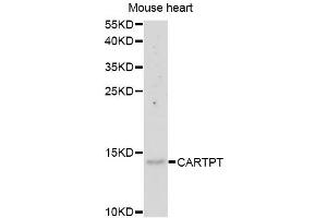 Western blot analysis of extracts of mouse heart, using CARTPT antibody (ABIN5975373) at 1/1000 dilution. (CARTPT Antikörper)