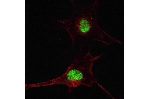Fluorescent confocal image of SY5Y cells stained with SOX2  antibody. (SOX2 Antikörper  (AA 251-284))