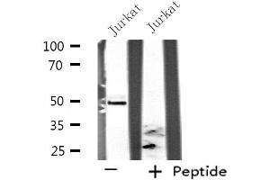 Western blot analysis of extracts from Jurkat cells, using SEPT6 antibody. (Septin 6 Antikörper  (Internal Region))