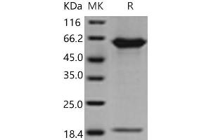 Western Blotting (WB) image for Proprotein Convertase Subtilisin/kexin Type 9 (PCSK9) (Active) protein (His tag) (ABIN7197529) (PCSK9 Protein (His tag))