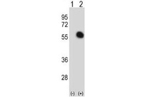 Western Blotting (WB) image for anti-GATA Binding Protein 2 (GATA2) (AA 380-407) antibody (ABIN3031028)