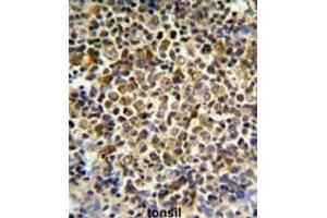 Immunohistochemistry (IHC) image for anti-Killer Cell Immunoglobulin-Like Receptor, Two Domains, Long Cytoplasmic Tail, 5B (KIR2DL5B) antibody (ABIN3003959) (KIR2DL5B Antikörper)