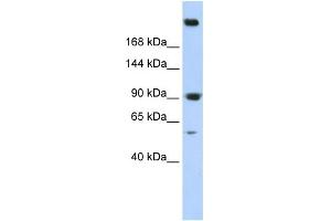 WB Suggested Anti-SPTAN1 Antibody Titration: 0. (SPTAN1 Antikörper  (N-Term))