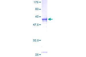 MPPED2 Protein (AA 1-294) (GST tag)