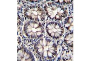 Formalin fixed, paraffin embedded human rectum tissue stained with CTBP2 Antibody (N-term) followed by peroxidase conjugation of the secondary antibody and DAB staining. (CTBP2 Antikörper  (N-Term))
