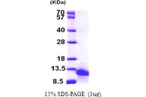 SDS-PAGE (SDS) image for Chemokine (C-C Motif) Ligand 18 (Pulmonary and Activation-Regulated) (CCL18) (AA 22-89) protein (His tag) (ABIN6386668)