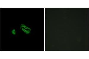 Immunofluorescence analysis of HeLa cells, using FPRL2 Antibody. (FPR3 Antikörper  (AA 304-353))