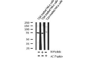 Western blot analysis on TSA treated HeLa cells lysate using AC-FKHR(K294) Antibody (AC-FKHR Antikörper)