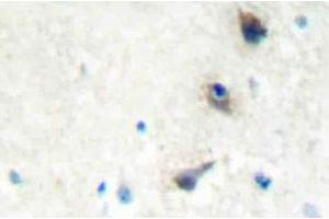 Immunohistochemistry (IHC) analyzes of IMK-1 antibody in paraffin-embedded human brain tissue. (LIM Domain Kinase 1 Antikörper)