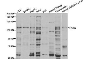 Western Blotting (WB) image for anti-Receptor Tyrosine Kinase-Like Orphan Receptor 2 (ROR2) antibody (ABIN1876821) (ROR2 Antikörper)