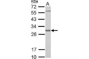 Western Blotting (WB) image for anti-BCL2-Like 1 (BCL2L1) antibody (ABIN2856151)