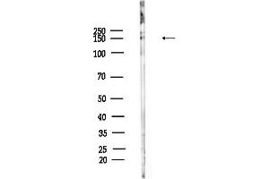 Western blot analysis of lysates from Rat brain, using Phospho-SRC3 (Thr24) Antibody at 1/1000 dilution.