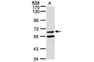 WB Image Sample(30 μg of whole cell lysate) A:Raji, 7. (FPGT Antikörper)