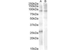 Image no. 1 for anti-Apolipoprotein B mRNA Editing Enzyme, Catalytic Polypeptide-Like 2 (APOBEC2) (Internal Region), (N-Term) antibody (ABIN374923) (APOBEC2 Antikörper  (Internal Region, N-Term))