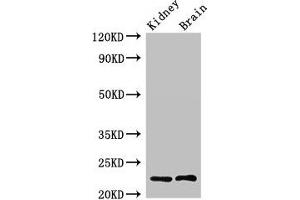 Western Blot Positive WB detected in: Rat kidney tissue, Mouse brain tissue All lanes: CHP1 antibody at 2. (CHP Antikörper  (AA 2-195))
