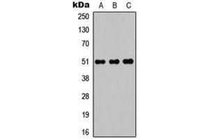 Western blot analysis of POTEA expression in HEK293T (A), Raw264.
