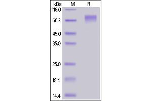 SDS-PAGE (SDS) image for Guanylate Cyclase 2C (Heat Stable Enterotoxin Receptor) (GUCY2C) (AA 24-430) (Active) protein (His tag,AVI tag,Biotin) (ABIN6973084)