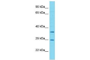 Host: Rabbit Target Name: FAHD1 Sample Type: Hela Whole cell lysates Antibody Dilution: 1. (FAHD1 Antikörper  (Middle Region))