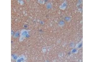 Used in DAB staining on fromalin fixed paraffin- embedded Kidney tissue (C6orf150 Antikörper  (AA 225-407))
