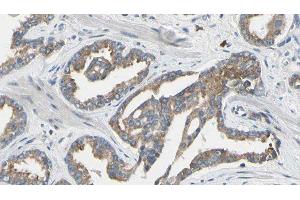 ABIN6277640 at 1/100 staining Human prostate tissue by IHC-P. (Asparagine Synthetase Antikörper  (N-Term))