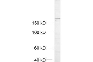 dilution: 1 : 500, sample: crude synaptosomal fraction of rat brain (P2) (UNC13A/Munc13-1 Antikörper  (AA 3-317))