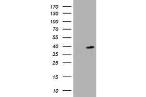 Image no. 1 for anti-Proliferating Cell Nuclear Antigen (PCNA) antibody (ABIN1500061)