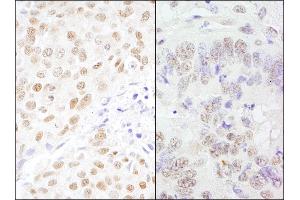 Immunohistochemistry (IHC) image for anti-Cleavage Stimulation Factor, 3' Pre-RNA, Subunit 3, 77kDa (CSTF3) (AA 667-717) antibody (ABIN7453683)