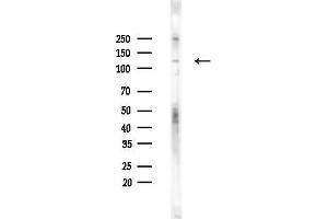 Western blot analysis of lysates from Hela cells(heat-shock,45 min treatment), using EPH Antibody at 1/1000 dilution.