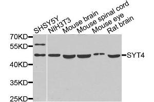 Western blot analysis of extracts of various cells, using SYT4 antibody. (SYT4 Antikörper)