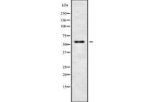 Western blot analysis of KCNG4 using Jurkat whole cell lysates