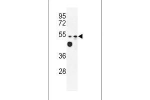 Tricellulin Antikörper  (C-Term)