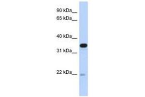 Image no. 1 for anti-Phosphotidylinositol Transfer Protein, beta (PITPNB) (AA 107-156) antibody (ABIN6743263)