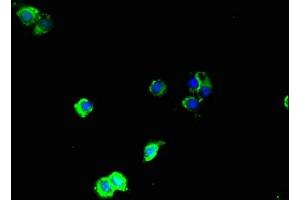 Immunofluorescent analysis of Hela cells using ABIN7160057 at dilution of 1:100 and Alexa Fluor 488-congugated AffiniPure Goat Anti-Rabbit IgG(H+L) (MAP3K8 Antikörper  (AA 1-300))