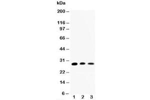 Western blot testing of AQP1 antibody and Lane 1:  rat kidney;  2: rat lung;  3: SMMC-7721 cell lysate