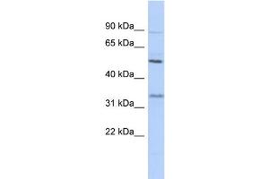 WB Suggested Anti-PRSS35 Antibody Titration: 0. (PRSS35 Antikörper  (N-Term))
