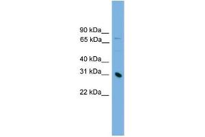 Human Jurkat; WB Suggested Anti-PRSS8 Antibody Titration: 0. (PRSS8 Antikörper  (Middle Region))
