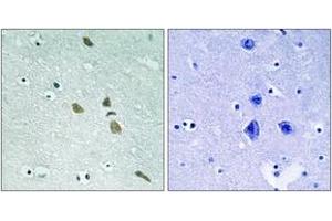 Immunohistochemistry (IHC) image for anti-Integrin-Linked Kinase (ILK) (AA 212-261) antibody (ABIN1533080)