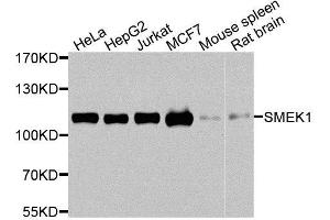 Western blot analysis of extracts of various cell lines, using SMEK1 antibody. (SMEK1 Antikörper  (AA 395-594))
