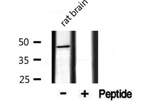 Western blot analysis of extracts from rat Brian, using CADM2 antibody. (CADM2 Antikörper  (Internal Region))