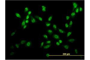 Immunofluorescence of monoclonal antibody to USF2 on HeLa cell. (USF2 Antikörper  (AA 1-100))