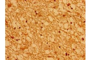 Immunohistochemistry of paraffin-embedded human brain tissue using ABIN7142982 at dilution of 1:100 (ASCL1 Antikörper  (AA 1-236))