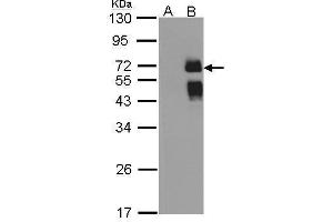 WB Image Western Blot analysis of ST6GAL1 expression in transfected 293T cell line by ST6GAL1 polyclonal antibody.