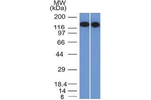 Western Blotting (WB) image for anti-CD22 Molecule (CD22) (AA 52-178) antibody (ABIN6941120)