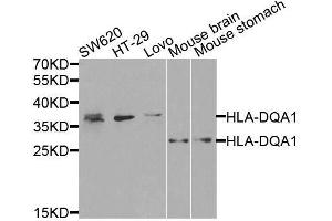 Western blot analysis of extracts of various cell lines, using HLA-DQA1 antibody. (HLA-DQA1 Antikörper  (AA 24-216))