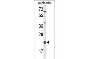 Western blot analysis of DGCR6 Antibody (Center) (ABIN653560 and ABIN2842939) in mouse bladder tissue lysates (35 μg/lane).