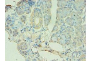 Immunohistochemistry of paraffin-embedded human pancreatic tissue using ABIN7145118 at dilution of 1:100 (ATG9B Antikörper  (AA 715-924))