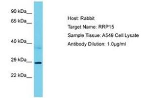 Image no. 1 for anti-Ribosomal RNA Processing 15 Homolog (RRP15) (AA 202-251) antibody (ABIN6750605) (RRP15 Antikörper  (AA 202-251))