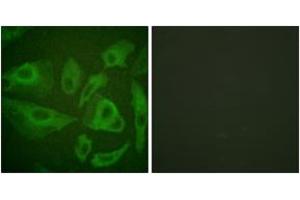 Immunofluorescence (IF) image for anti-TNF Receptor Superfamily, Member 6 (FAS) (AA 257-306) antibody (ABIN1532613)