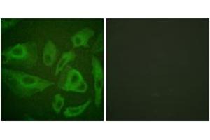 Immunofluorescence analysis of HeLa cells, using FAS (Ab-291) Antibody. (FAS Antikörper  (AA 257-306))